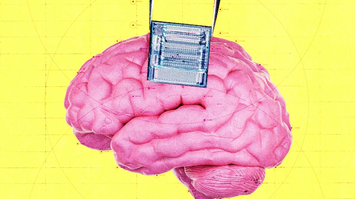 OpenAI e Peter Thiel financiam implante cerebral para detectar câncer